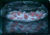 candybowl.jpg (59092 bytes)