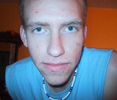 My Face Returns