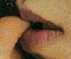 yoshiki's lips... yum yum...