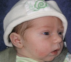 I got a snail on my head!