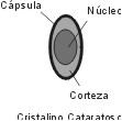 Cristalino_catarata.jpg (3709 bytes)