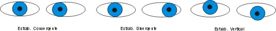 ESTRABISMO.jpg (12123 bytes)