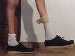 The CMT foot with an AFO