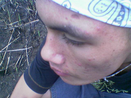recall__makulot_2007_2031