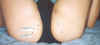 Adrian_3rd_Injection_Bensignor_xxadrian_20021015_132643_rev_B.jpg (287000 bytes)