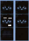CT_Scan_Injection_xxAdrian_20020704_193000_Rev_Aweb_markup.jpg (103818 Byte)