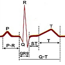 Electrocardiogram