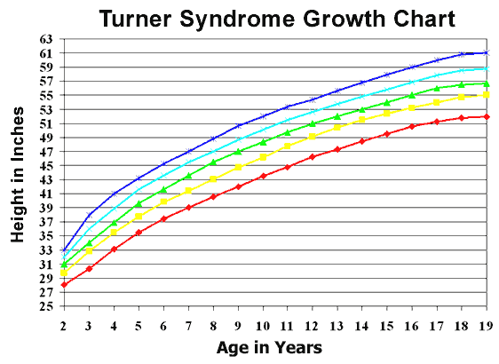 Down Syndrome Growth Chart 2016