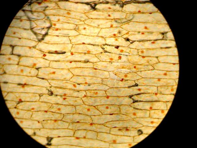 Onion Cells With Iodine