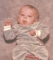 Age 4mos.