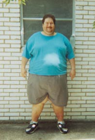 Doug Heyde 1 week post-op