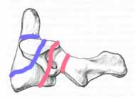 hang_model.jpg (9792 bytes)