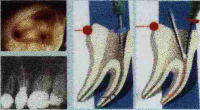 Teeth Graphic