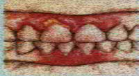 Teeth Graphic
