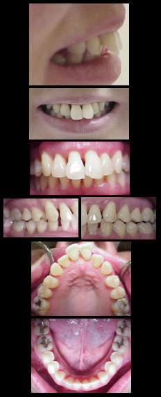 ortho problem