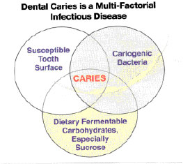 Dental Caries