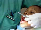 Save a Knocked-Out Tooth
