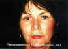 Facial1.jpg (69495 bytes)