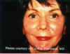 Facial1a.jpg (65672 bytes)
