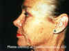 Facial2.jpg (69899 bytes)
