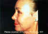 Facial2a.jpg (58687 bytes)