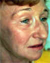 Facial3a.jpg (84810 bytes)
