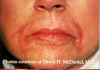 Labios1a.jpg (68089 bytes)