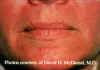 Labios2.jpg (63861 bytes)