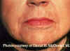 Labios2a.jpg (58087 bytes)
