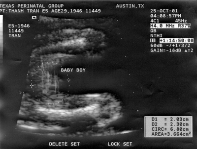 ultrasound