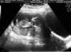 babywalker13weeks_small.jpg