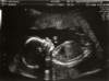 babyhall2_small.jpg