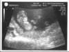 babyhall_small.jpg