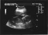 clairsandadriansbaby_small.jpg