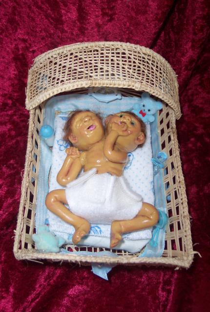 Johnny, the 2 headed Jaundiced baby