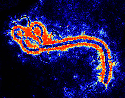 http://www.geocities.ws/eboladrc/Ebola02_jpg.jpg