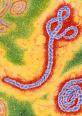 Microscopic view of the ebola virus