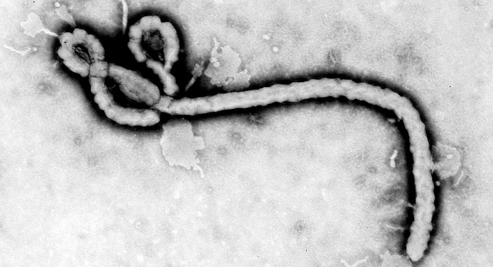 ebola virus 3