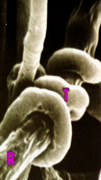 Trichoderma en acci�n