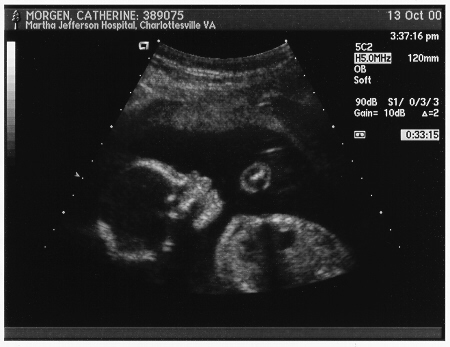 Baby's face