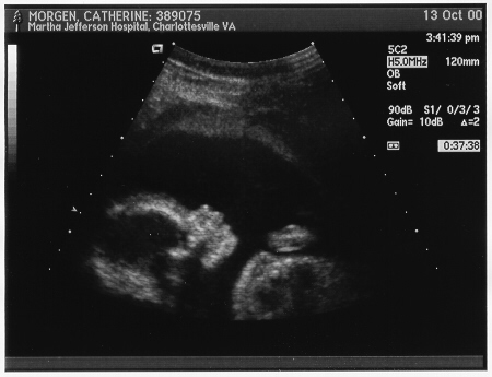 Baby's face