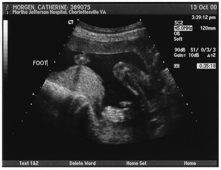 Baby's foot