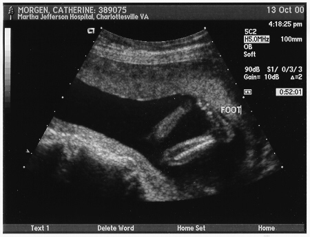Baby's legs