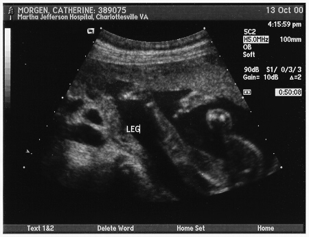 Another of baby's legs