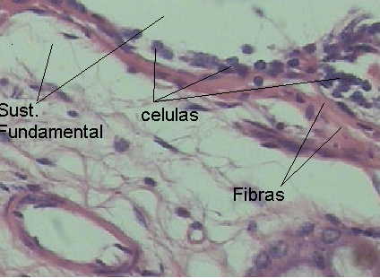 (+++)celulas (+)Fibras (+++)Sust. Fundamental