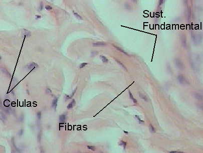 (+)celulas (+++)Fibras (+)Sust. Fundamental