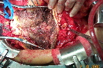 surgical picture