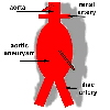 AAA Schematic picture