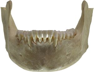 mandibula3
