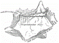 etmoides4